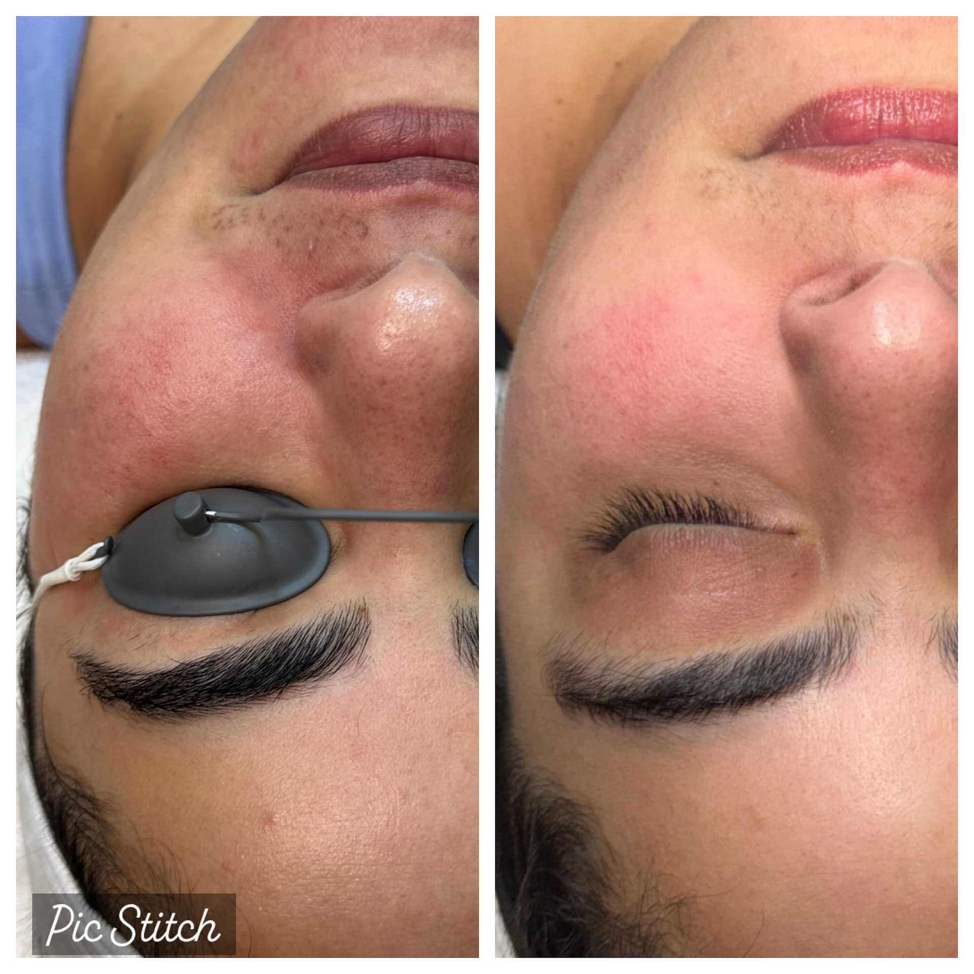 Before and after close-up of a woman's face showing results of a beauty treatment on her eyebrows.