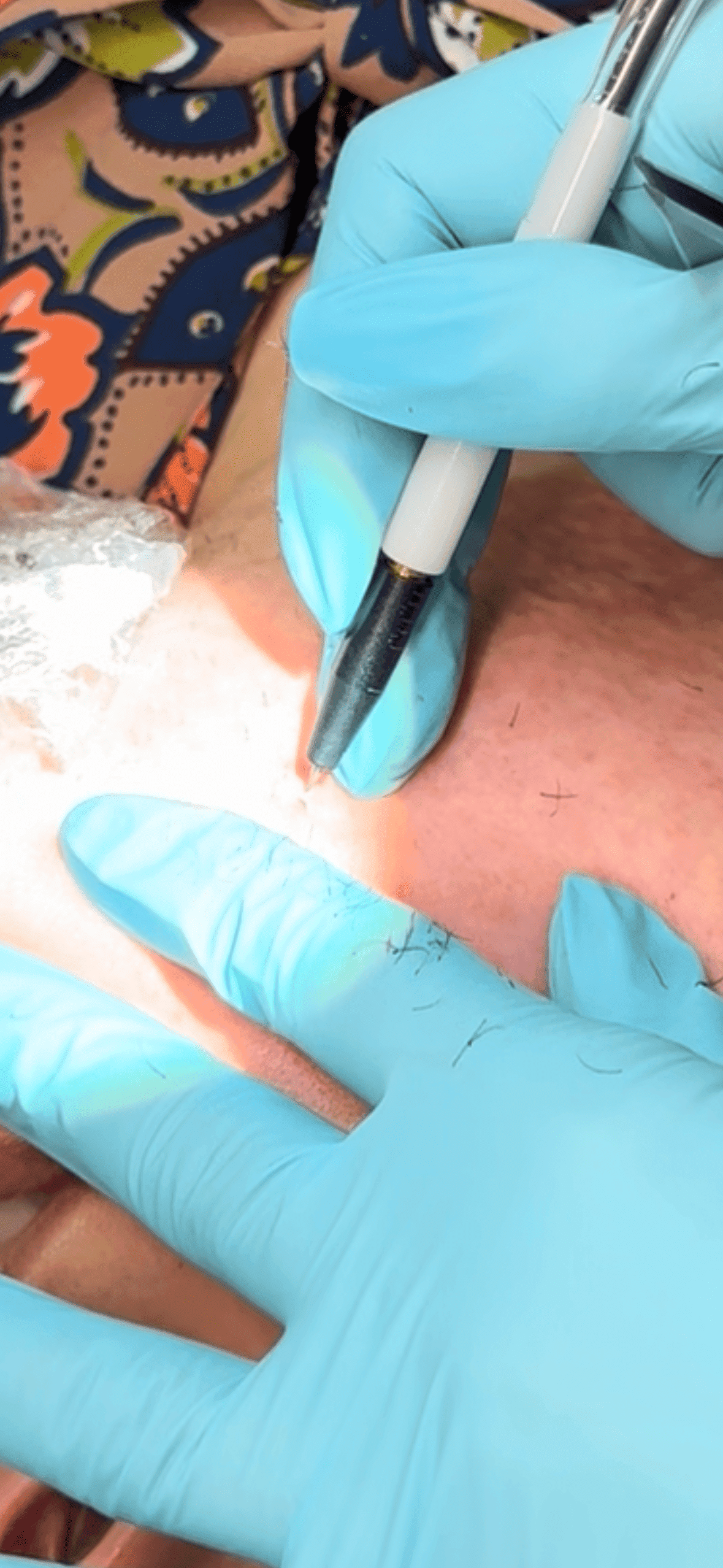Eyebrow tattoo procedure in progress, with gloved hands and pen on the skin.