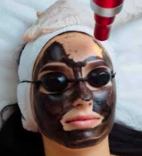 Person with a facial mask and protective goggles undergoing a skincare treatment with a red device.