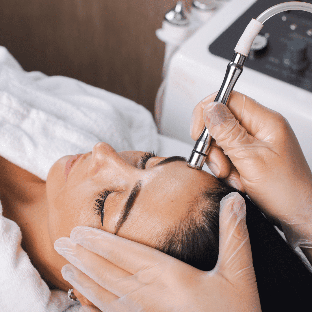 Facial treatment with a microdermabrasion tool at a spa.