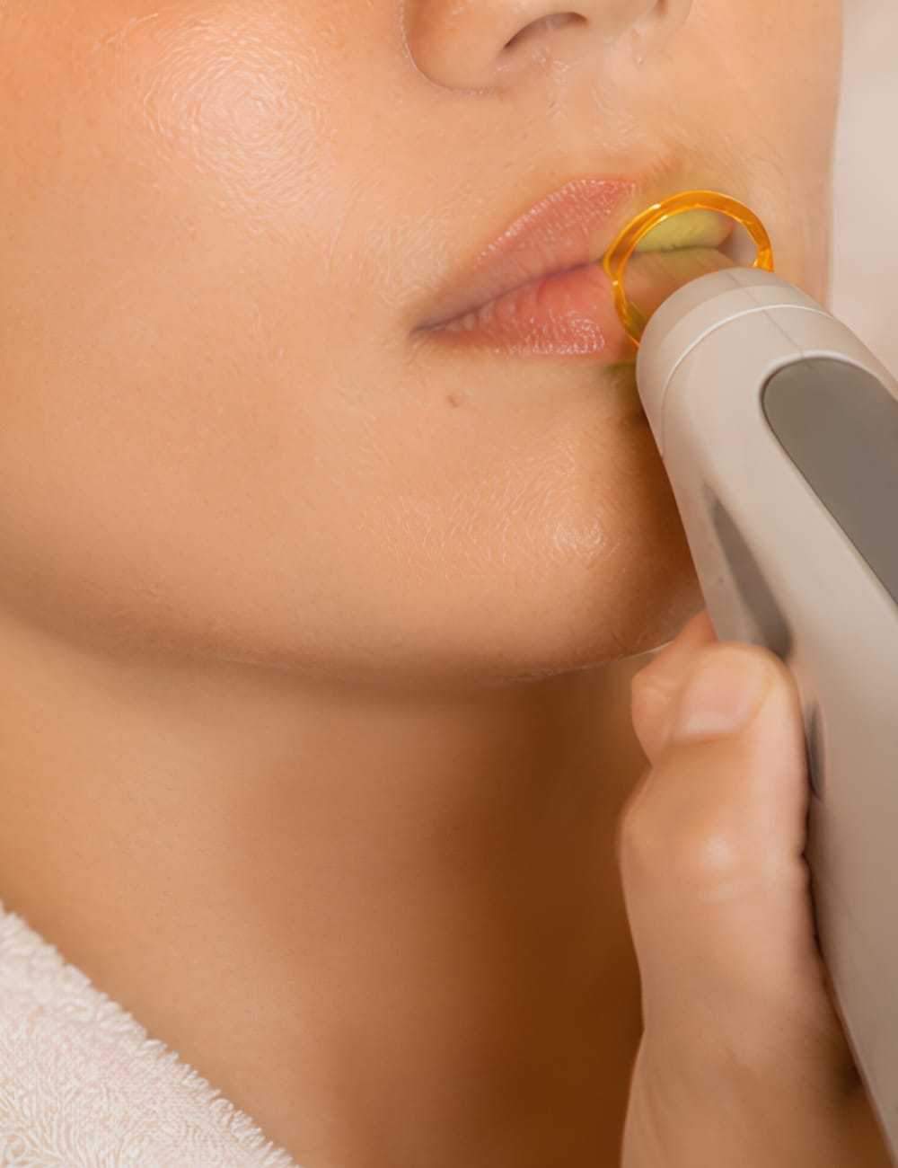 Person using a handheld device for skincare treatment on their lips.