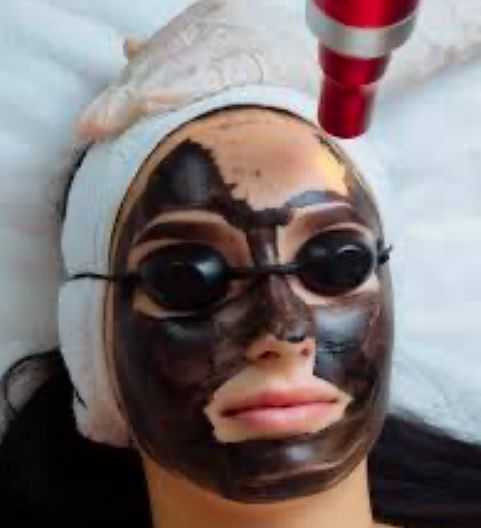 Person with a facial mask and protective goggles undergoing a skincare treatment with a red device.