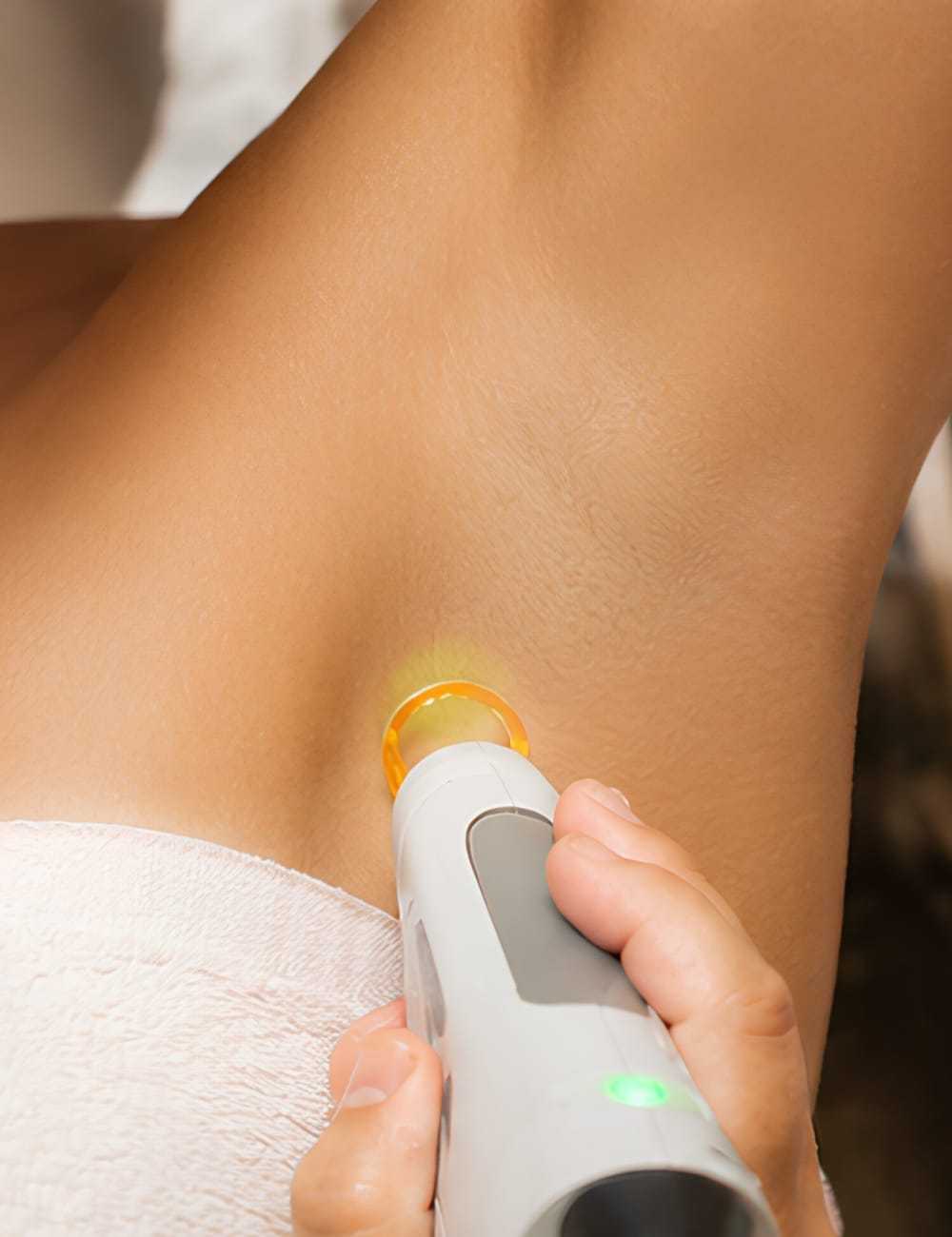 Person receiving laser hair removal under the arm.