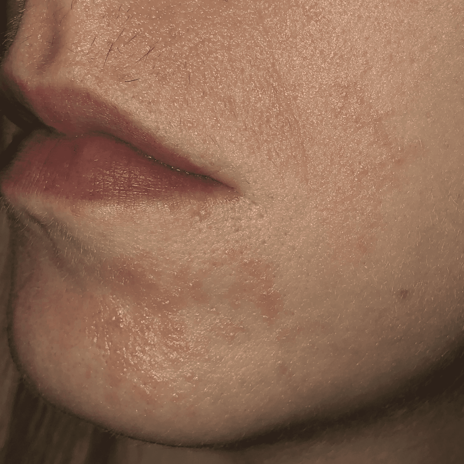 Close-up of a person's face showing skin texture and blemishes.