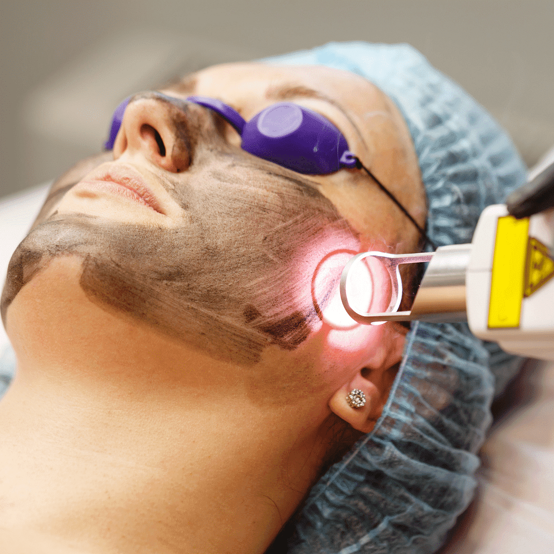 Patient receiving laser facial treatment with protective eyewear and cosmetic mask.