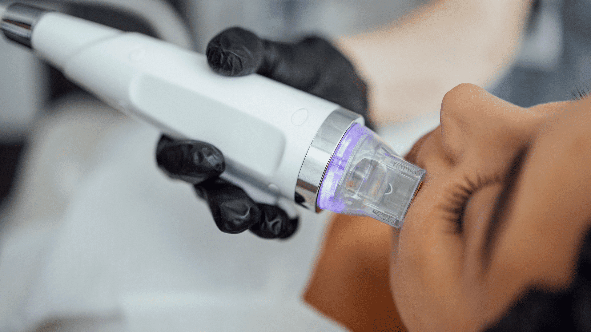 Person receiving a skin treatment with a modern device operated by a professional in black gloves.